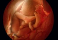 Developpement Foetal 9eme Mois De Grossesse Docteur Guilherme Romain Developpement Foetal 9eme Mois De Grossesse Docteur Guilherme Romain